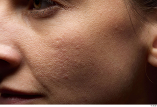 HD Face Skin Zolzaya cheek face skin pores skin texture…